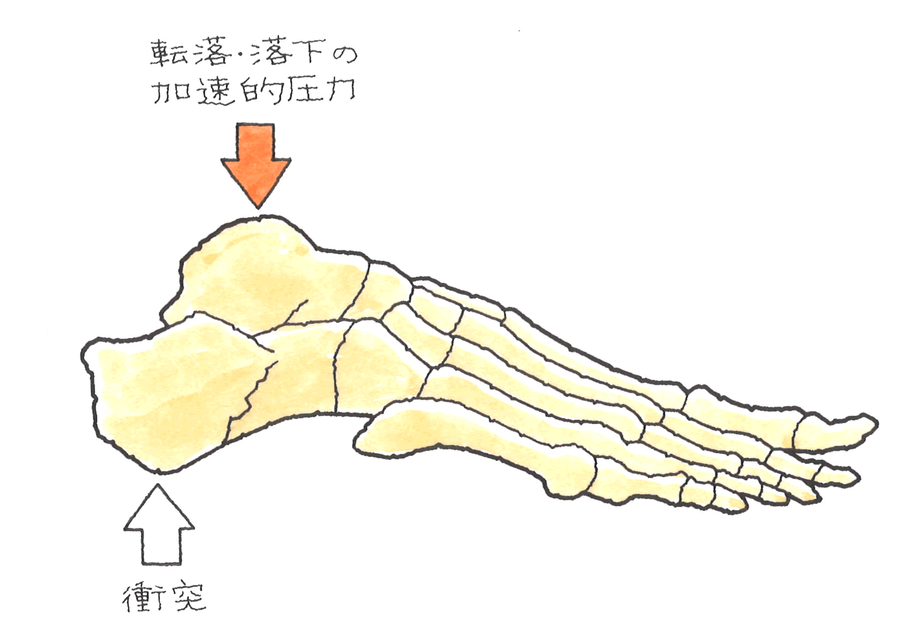 図４　衝突.gif